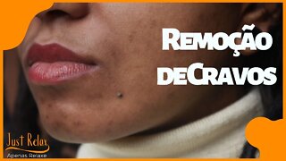 Só Relaxe Remoção de Cravos - Remove Cravos e Espinhas Asmr - Just Relax | Apenas Relaxe