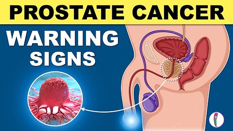 Prostate Cancer Signs | Warning Signs of Prostate Cancer