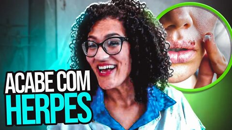 Herpes Simples - Tratamento Que Pode Acabar Com Herpes