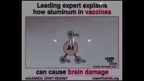 aluminum in vaccine can cause brain damage.