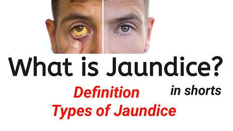 What is Jaundice | Definition | Types of Jaundice | Pathology