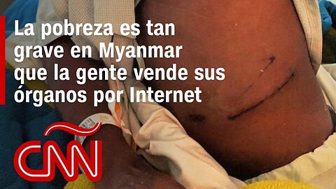 La pobreza es tan grave en Myanmar que la gente se ofrece a vender sus riñones por Internet