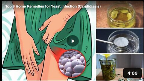 Learn more about eight remedies for a yeast infection