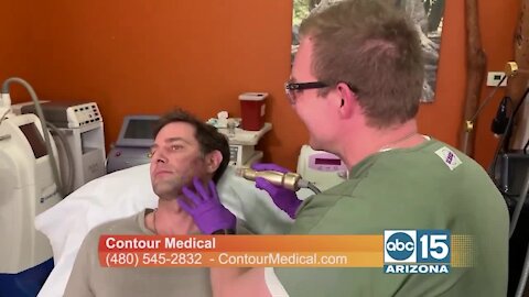 Contour Medical has new treatment to reduce scars, fine lines, acne & pores