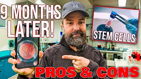 Stem Cell Therapy • 9 Months Later • Did It WORK? • Pros & Cons To Stem Cell Therapy