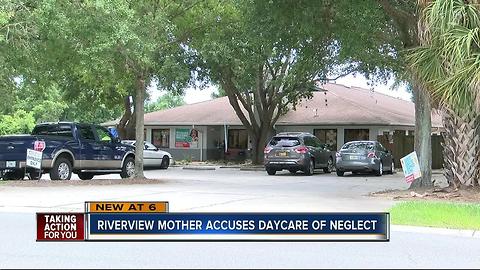 Riverview mother accuses daycare of neglect