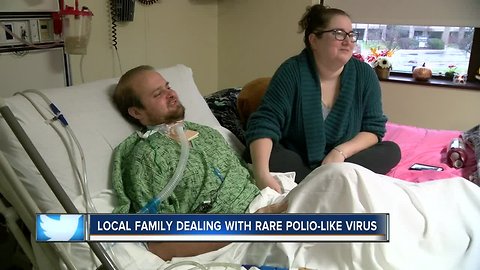 Milwaukee man recovering from rare polio-like virus