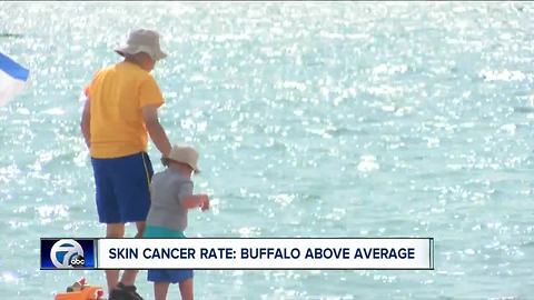 Skin cancer rate: Buffalo above average