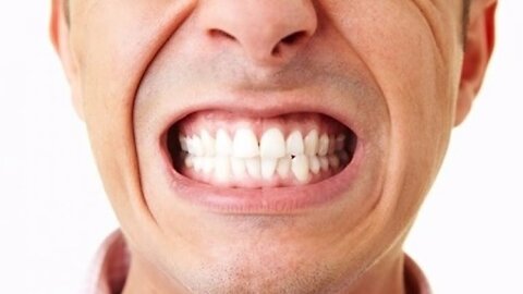 CAUSAS DEL BRUXISMO RECHINAR LOS DIENTES O APRETAR LA MANDIBULA Y LA CURACION NATURAL