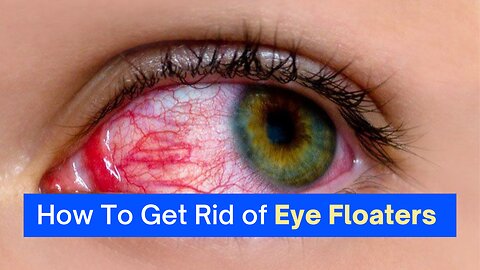 Improve Your Eyesight!! NO MORE EYE FLOATERS