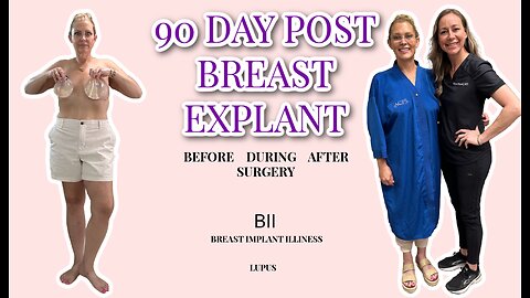 BREAST IMPLANT EXPLANT + BBI SYMPTOMS + MY CONFIDENCE + IM HAPPIER & HEALTHIER