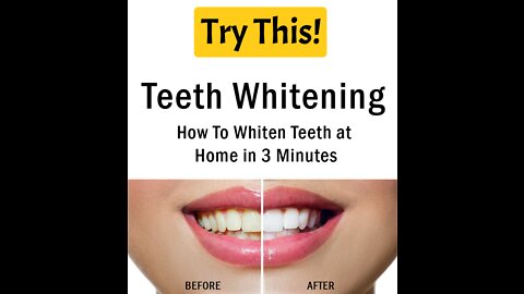 How To Get WHITER TEETH QUICKLY IN 2022!!!