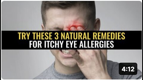 Try these 3 natural remedies for itchy eye allergies