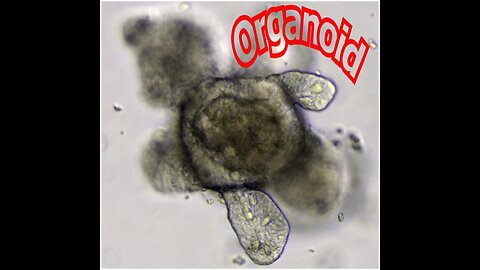 Organoids