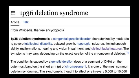 💉☠️ WENDY WILLIAMS "COVID VACCINE" 1p36 GENE DELETION FRONTOTEMPORAL DEMENTIA TODD CALLENDER