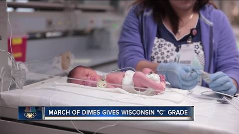 Wisconsin's premature birth rate rises again