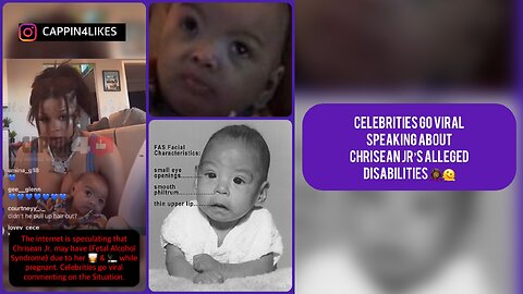 Celebrities Go Viral Speaking About CHRISEN JR’s Alleged Disabilities