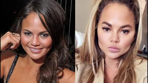 John Legend's Wife Chrissy Teigen REVEAL NEW FACE She Fixed After B0TCHED Surgery