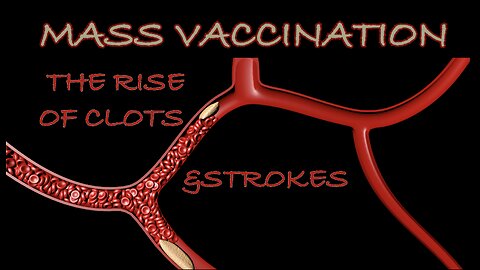 MASS VACCINATION: THE RISE OF CLOTS AND STROKES