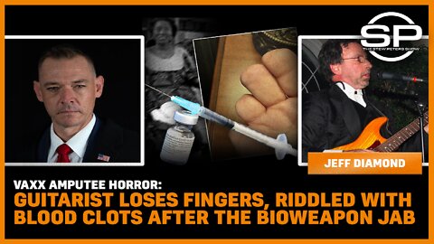 Vaxx Amputee Horror: Guitarist Loses Fingers, Riddled With Blood Clots After The Bioweapon Jab