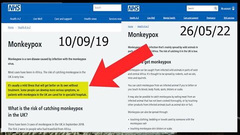 THE NHS EDITING THE MONKEYPOX PAGE LOOKS A BIT SUSPECT