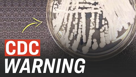 CDC Warns of Dangerous Fungal Infection Spreading Through US at ‘Alarming Rate’