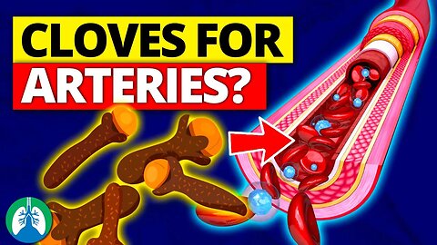 Are Cloves Good for Your Arteries and Cardiovascular System ❓