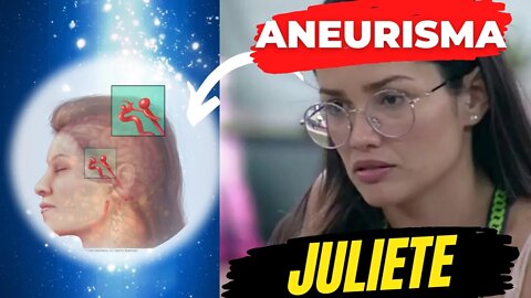 O QUE É ANEURISMA? Juliette Falou Sobre