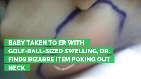 Baby Taken to ER with Golf-ball-Sized Swelling, Dr. Finds Bizarre Item Poking Out Neck