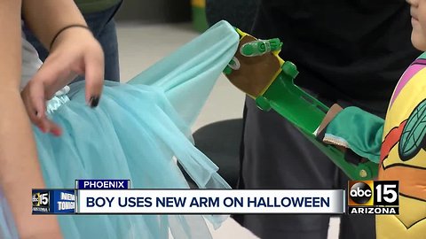 Boy uses new prosthetic arm on Halloween