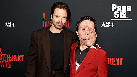 Sebastian Stan calls out reporter for describing co-star Adam Pearson as a 'beast' over facial disfigurement