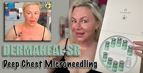 Dermaheal SR, Deep Microneedling My Chest! AceCosm, Code Jessica10 saves you money