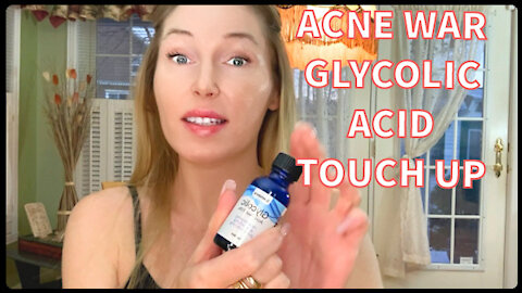 #GlycolicAcid #70%acid #acne #skincare #HOWTO #getridofacne