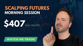 WATCH ME TRADE | +$407 PROFIT | DAY TRADING Nasdaq Futures Trading - Scalping Day Trading