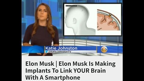 Elon Musk | Elon Musk Is Making Implants To Link YOUR Brain With A Smartphone