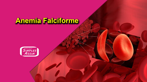 Anemia Falciforme, esclarecendo dúvidas