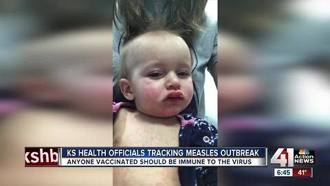 Investigation into KS measles outbreak continues