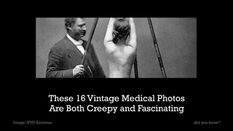 These 16 Vintage Medical Photos Are Both Creepy and Fascinating