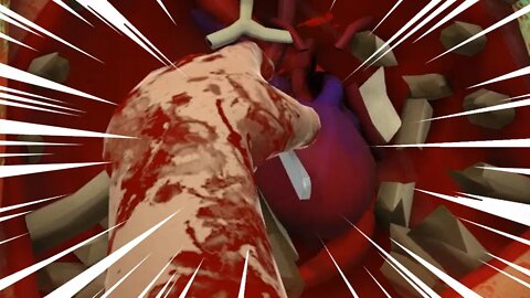 Let's Do This For Real (Surgeon Simulator: Heart Transplant)