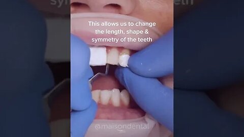 Dental And Teeth Hygiene