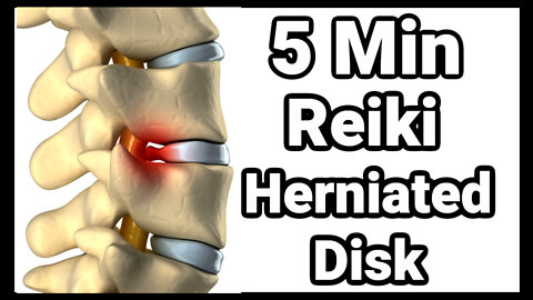 Reiki l Herniated Disk l 5 Minutes Session l Healing Hands Series l 963 Hz