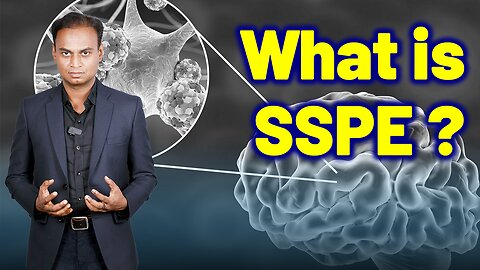 What is SSPE? or Subacute Sclerosing Panencephalitis or Dowson Rare Disease | Treatment Cure Relief