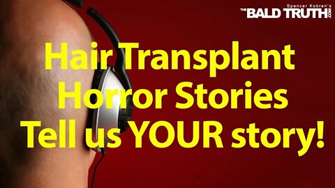 The Bald Truth for Friday August 30th, 2019 - Hair Transplant Horror Stories