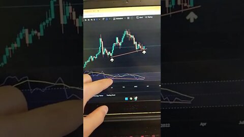 Technical Analysis 🤯🧠😎 Candlestick | Crypto | Stock | Market | Forex | Trading | #Shorts