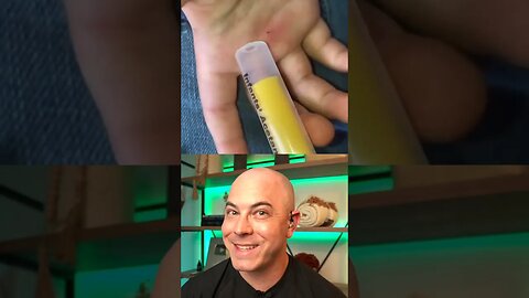 Doctor reacts to using the syringe method for splinter removal! #dermreacts #doctorreacts #splinter