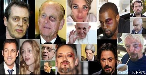 “Black Eye Club” Forever Victims Of The Globalist Cabal!!!!!!!!!!!