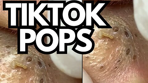 TIKTOK POPS