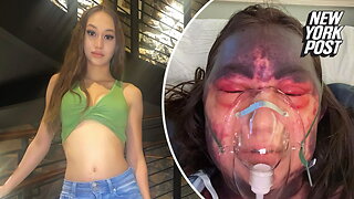 Florida woman claims she was left temporarily blinded and bruised after receiving multiple vaccinations at once