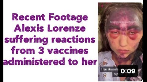 Recent Footage: Alexis Lorenze suffering reactions from 3 vaccines administered to her