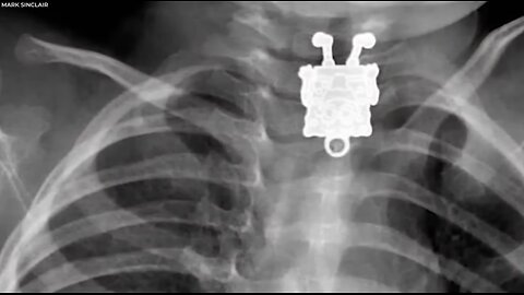 🦴 20 STRANGEST Things Discovered By X Rays 🔍